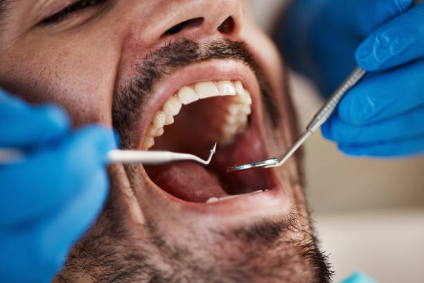 Best Emergency Tooth Extraction in Somonauk, IL