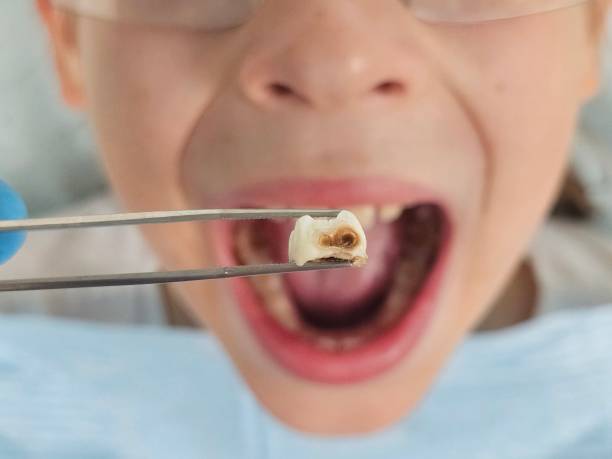 Best Walk-In Emergency Dentist in Somonauk, IL